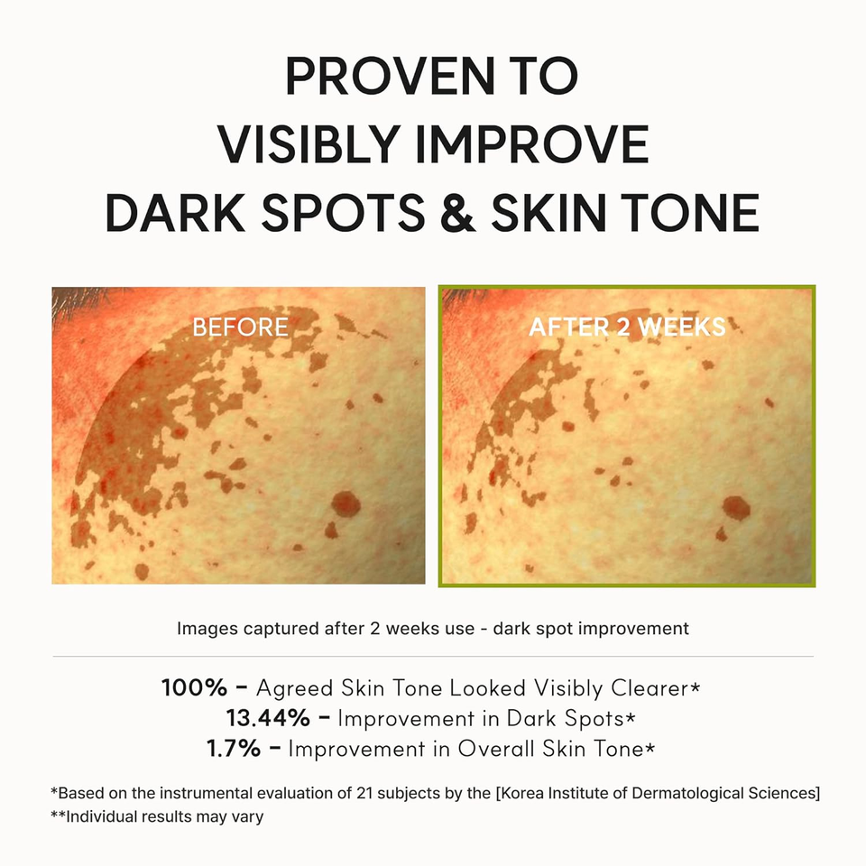 Vitamin C & Glutathione Booster Shot