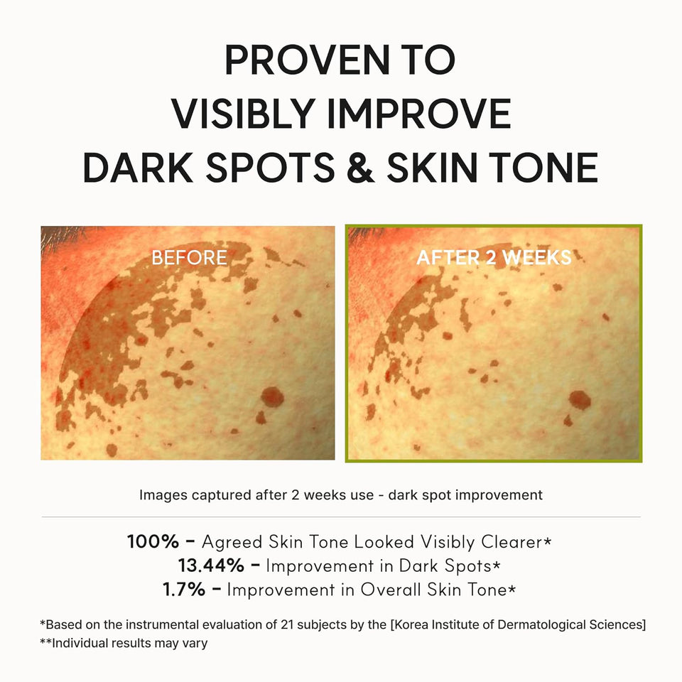 Vitamin C & Glutathione Booster Shot